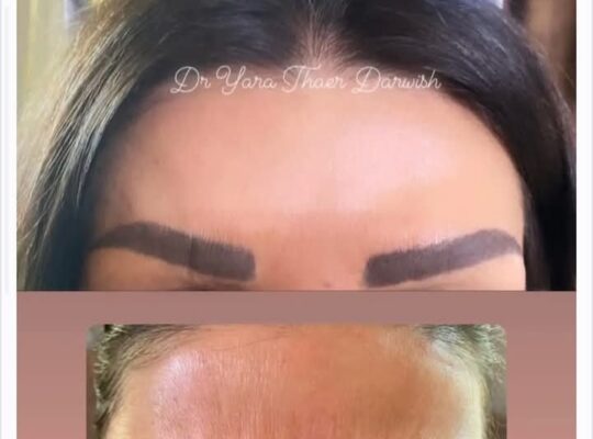 الدكتورة يارا ثائر درويش طب أسنان وتجميل غير جراحي