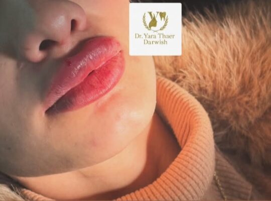 الدكتورة يارا ثائر درويش طب أسنان وتجميل غير جراحي