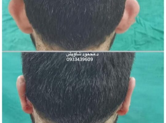 الدكتور محمود صالح شاويش