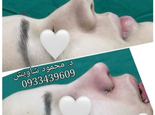 الدكتور محمود صالح شاويش