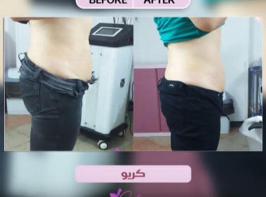 مركز سيلينا بيوتي