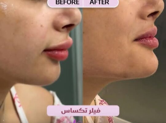 مركز سيلينا بيوتي