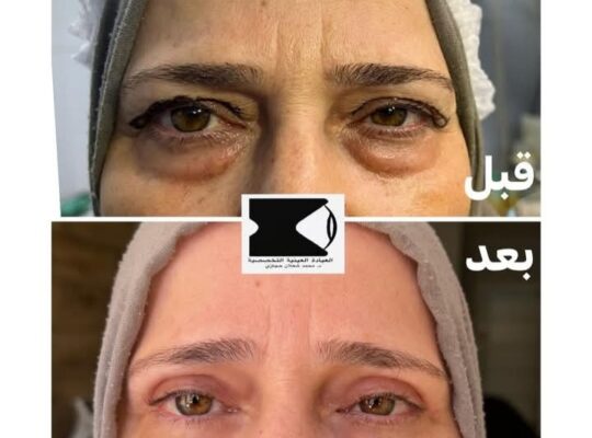 مركز العناية بالعين _ الدكتور محمد شعلان حجازي