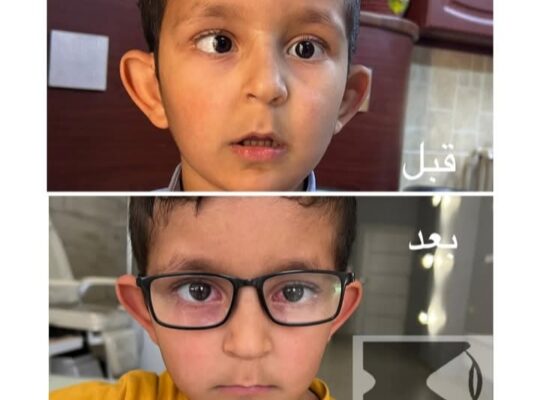 مركز العناية بالعين _ الدكتور محمد شعلان حجازي
