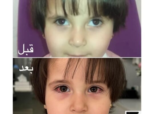 مركز العناية بالعين _ الدكتور محمد شعلان حجازي