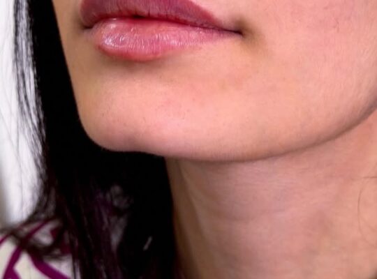 الدكتور عمران الكفيري طبيب أمراض جلدية وتجميل