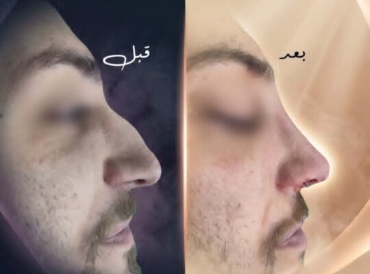 الدكتور محمد محمود رسلان أخصائي إذن أنف